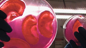 Elma dilimlerinden yapay kulak üretildi 