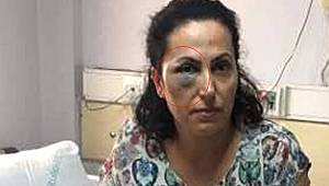 Samsun'da bayan doktoru darp eden kişi serbest kaldı 