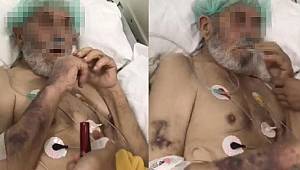 Yaşlı adama yoğun bakımda olay görüntüler 