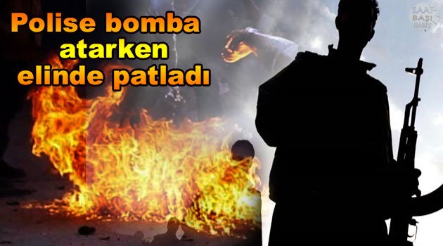 Bomba elinde patladı polisler kurtuldu