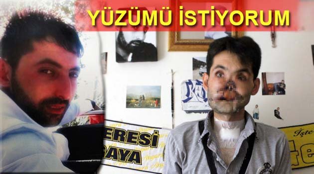 Yüzü tamamen parçalandı